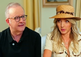 PM Australia Anthony Albanese Minta Maaf usai Komentar tentang Kylie Minogue Tuai Kritik